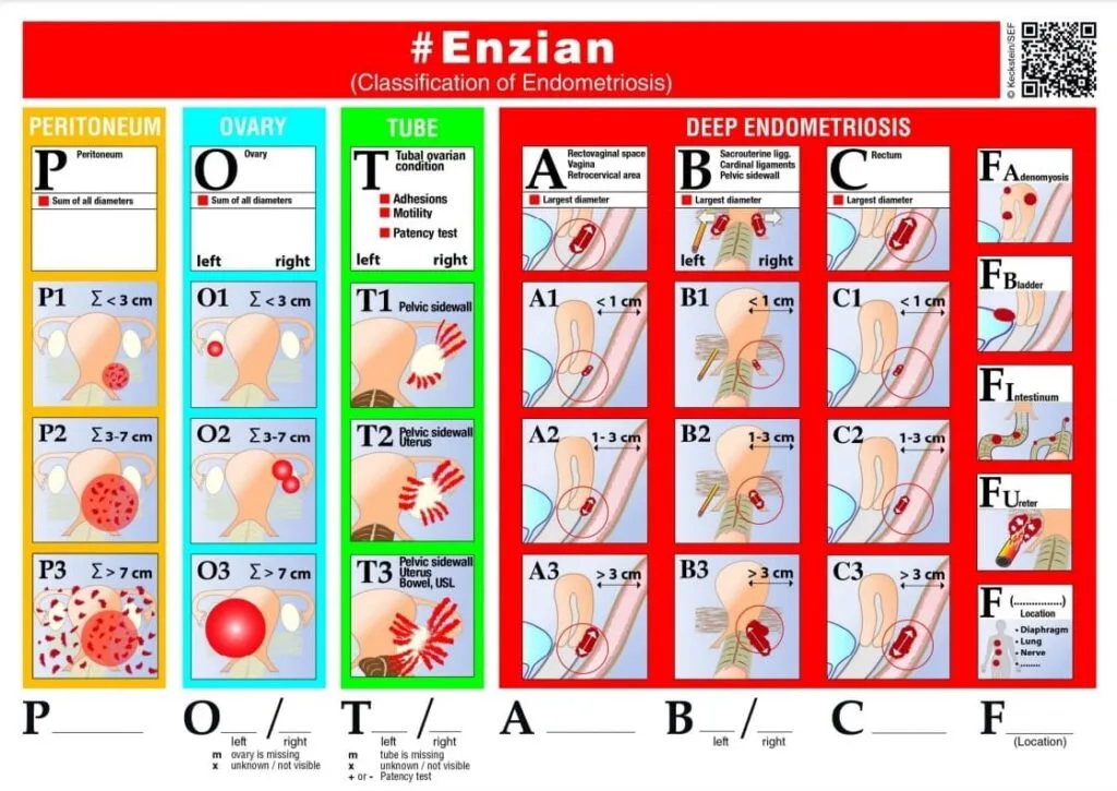 Czym jest endometrioza, jak się objawia i jak diagnozuje? 1 enzian